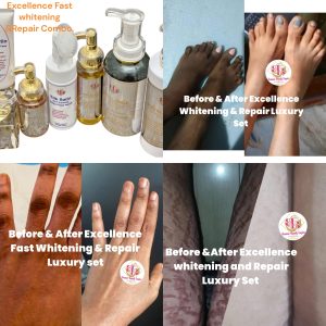 Sets and Combo products